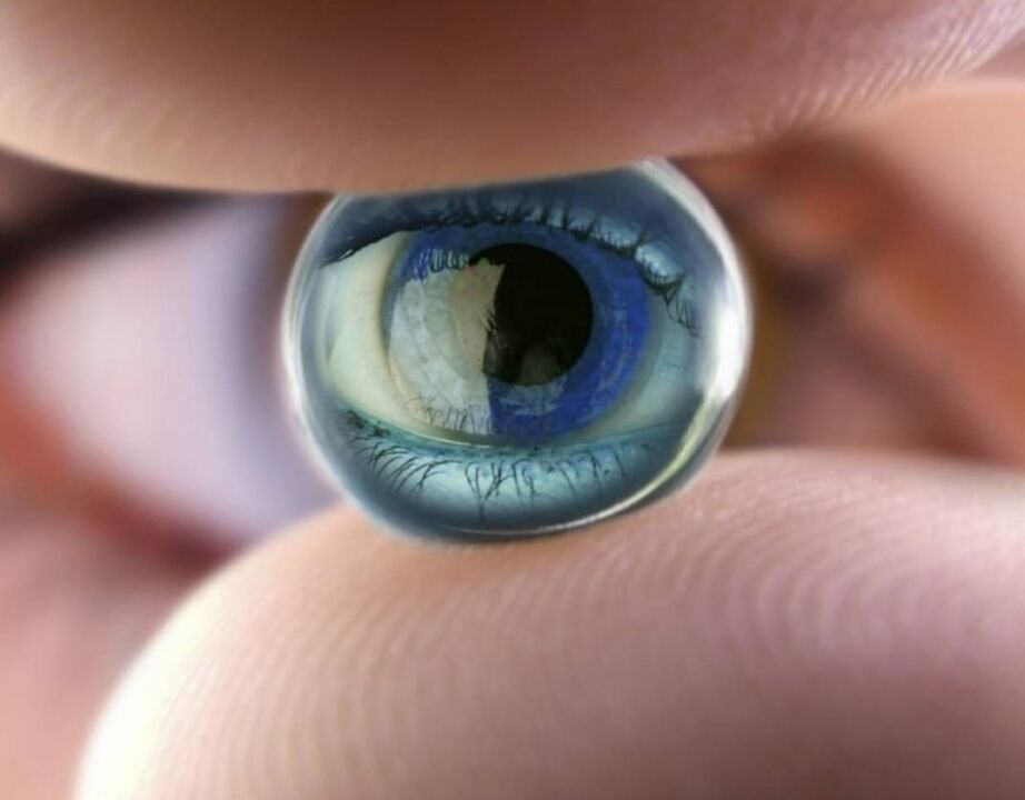 Nacht Orthokeratologische Linsen stoppen den Fortschritt der Sehbehinderung